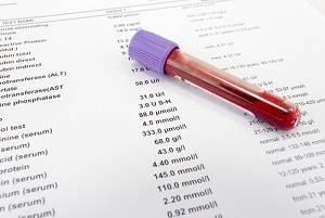 blood test, Arlington Heights criminal defense lawyer